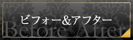 ビフォーアフター