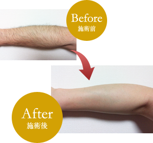 結果へのこだわり