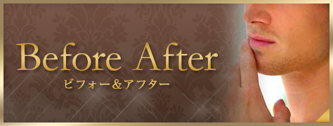 ビフォーアフター